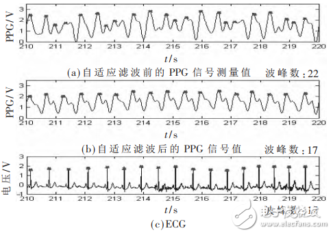 一种基于STM32和PPG技术的腕戴式心率计设计