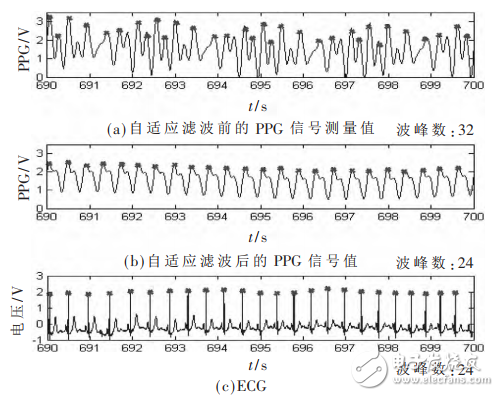 一种基于STM32和PPG技术的腕戴式心率计设计