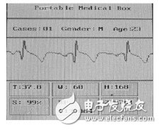  基于STM32的便携体检装置的设计与实现